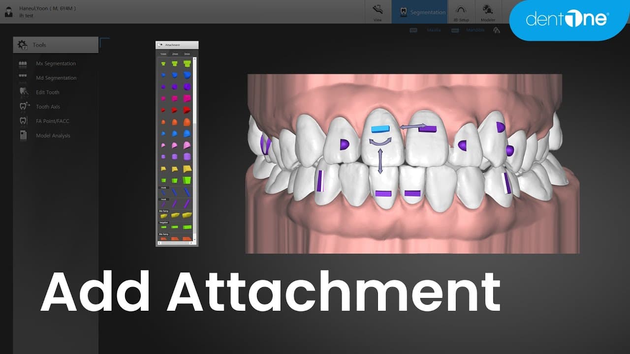Add Attachment