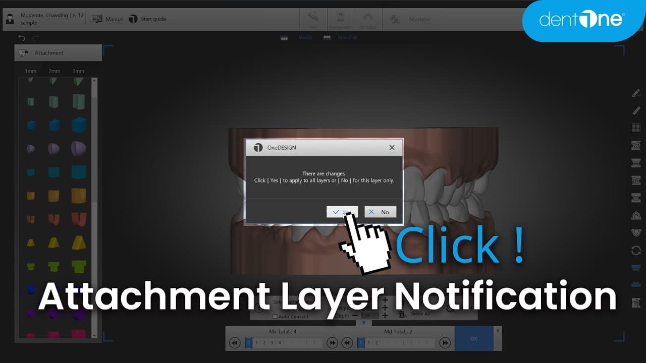 Attachment를 추가한 Layer에 따른 적용 범위