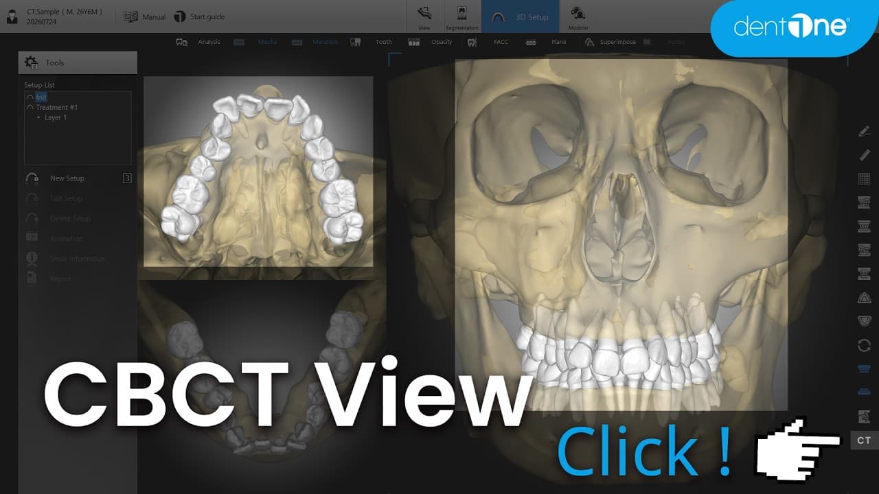 CBCT View