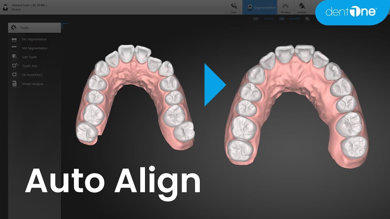 Auto Align