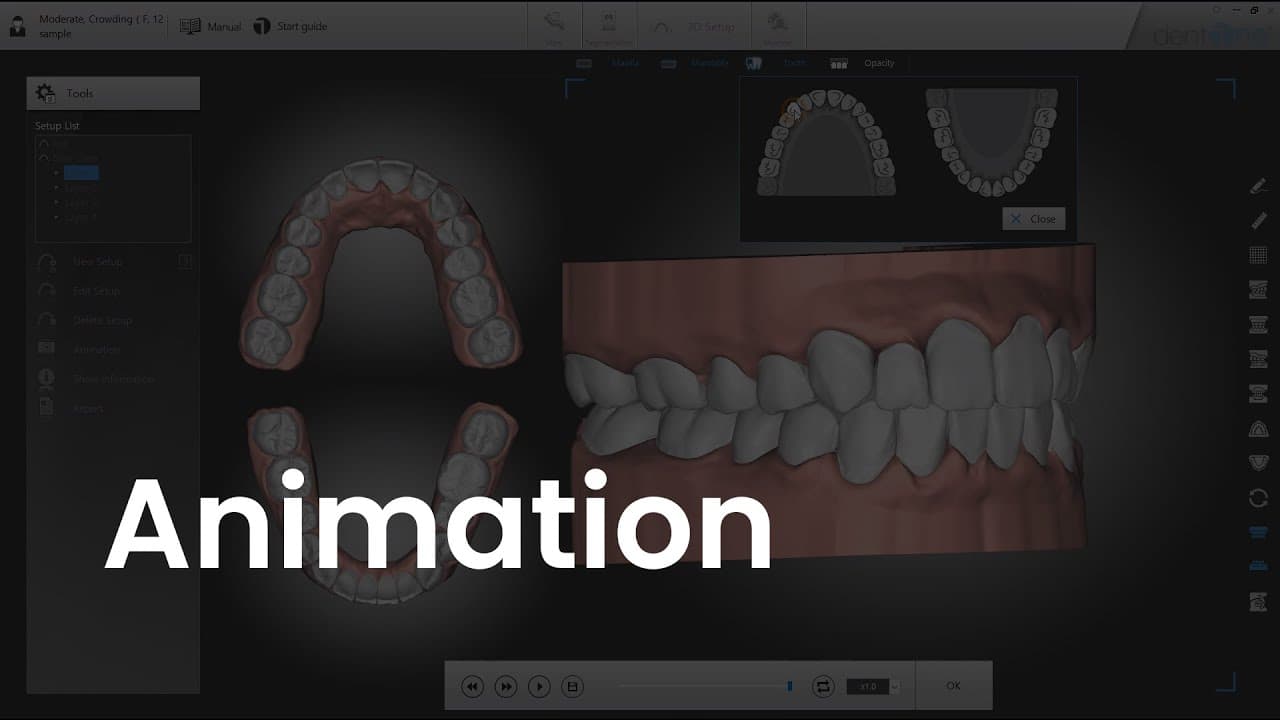 Animation