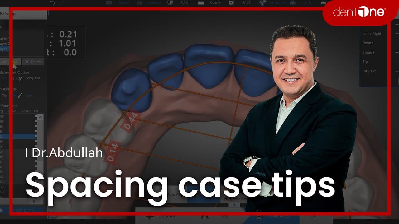 #1 Spacing case tips