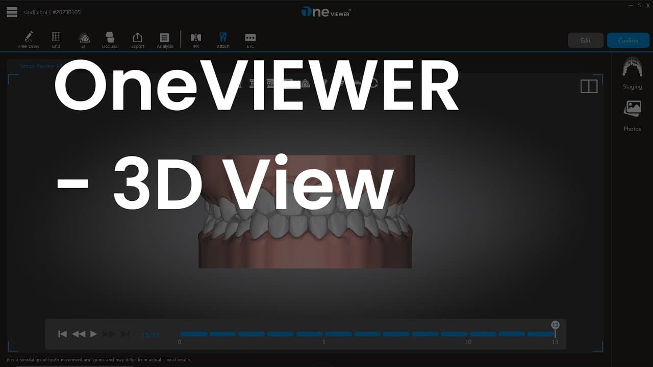 3D Viewer 회전 / 확대 축소 / 이동