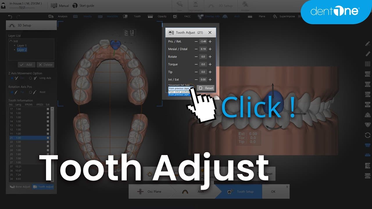 Tooth Adjust