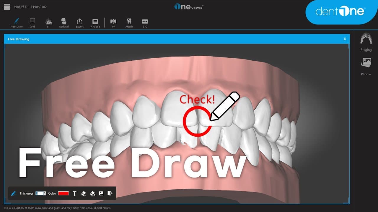Free Draw