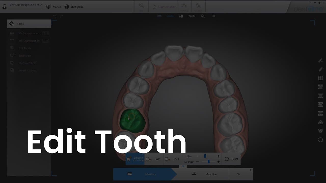 Edit Tooth