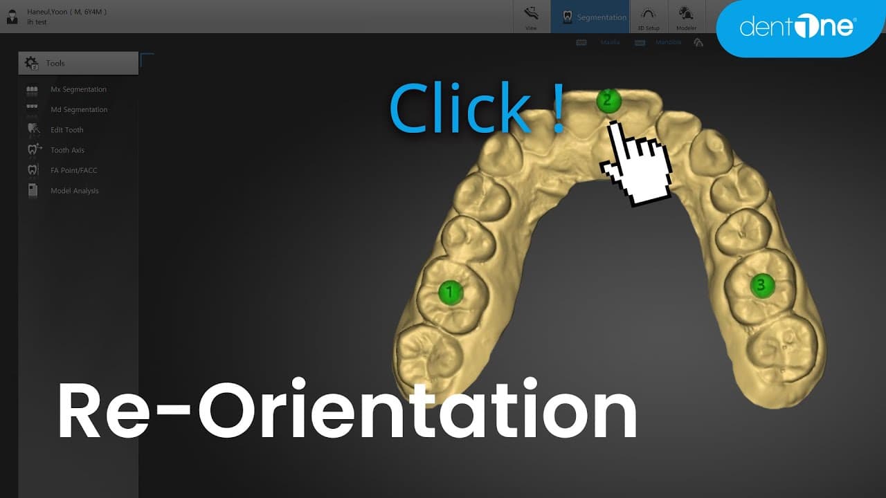 Re-Orientation