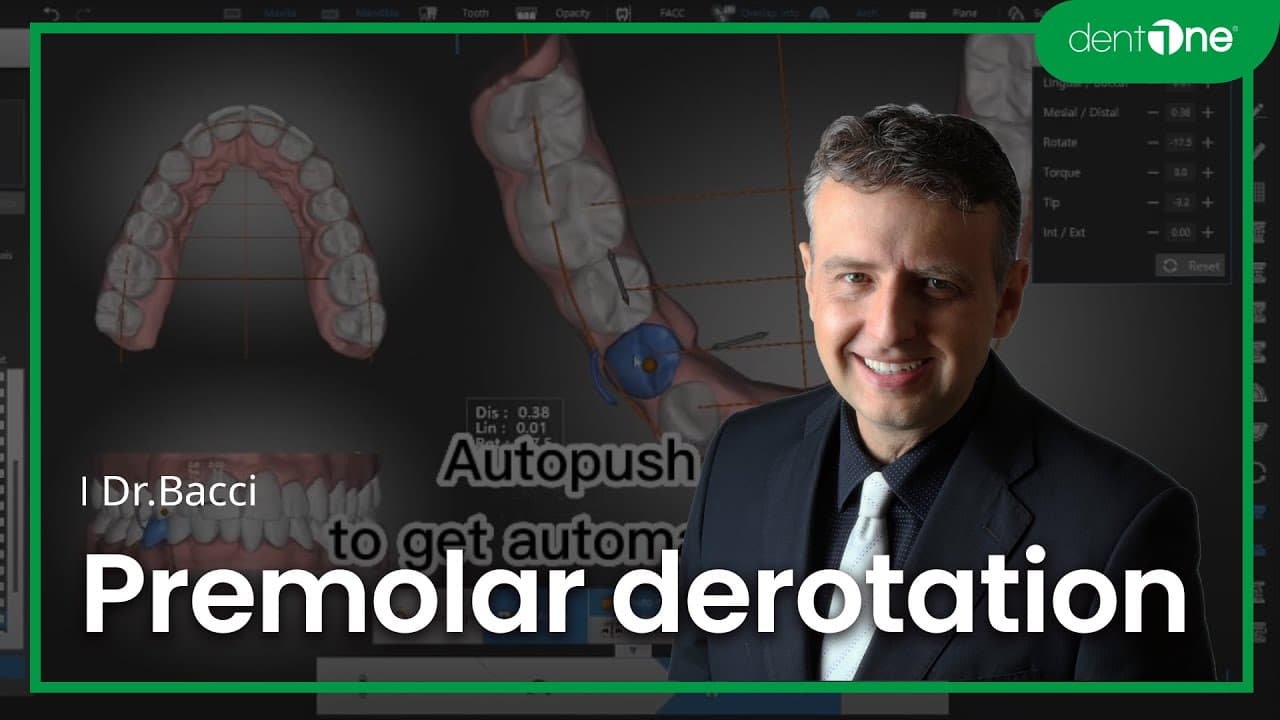 #2 Premolar derotation