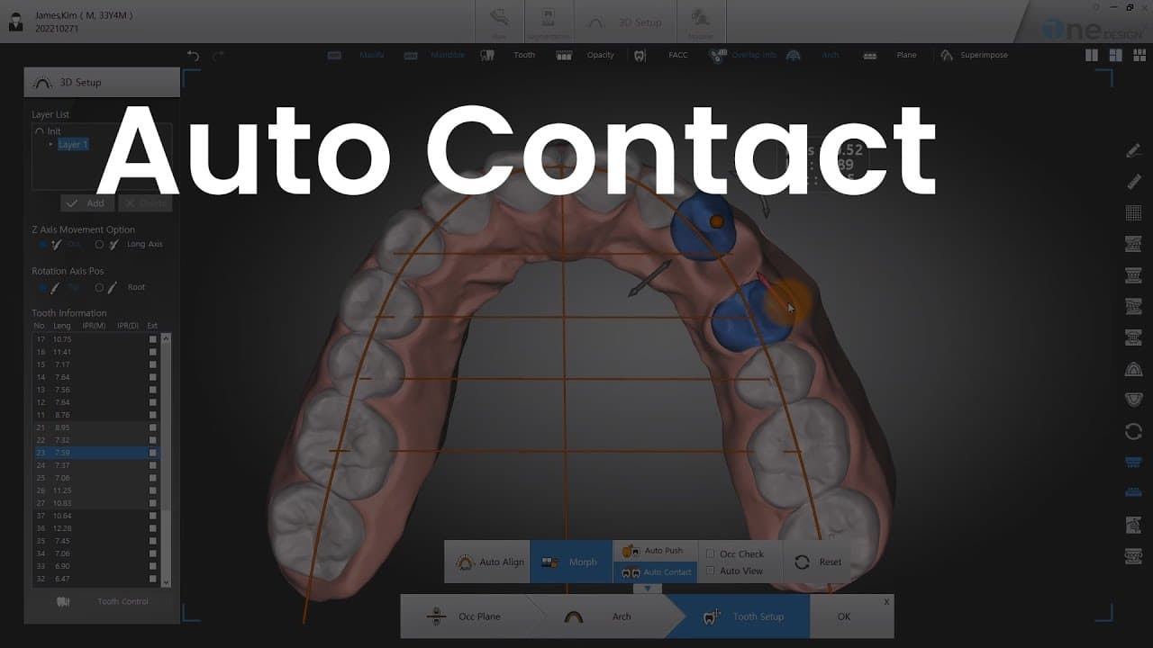Auto Contact