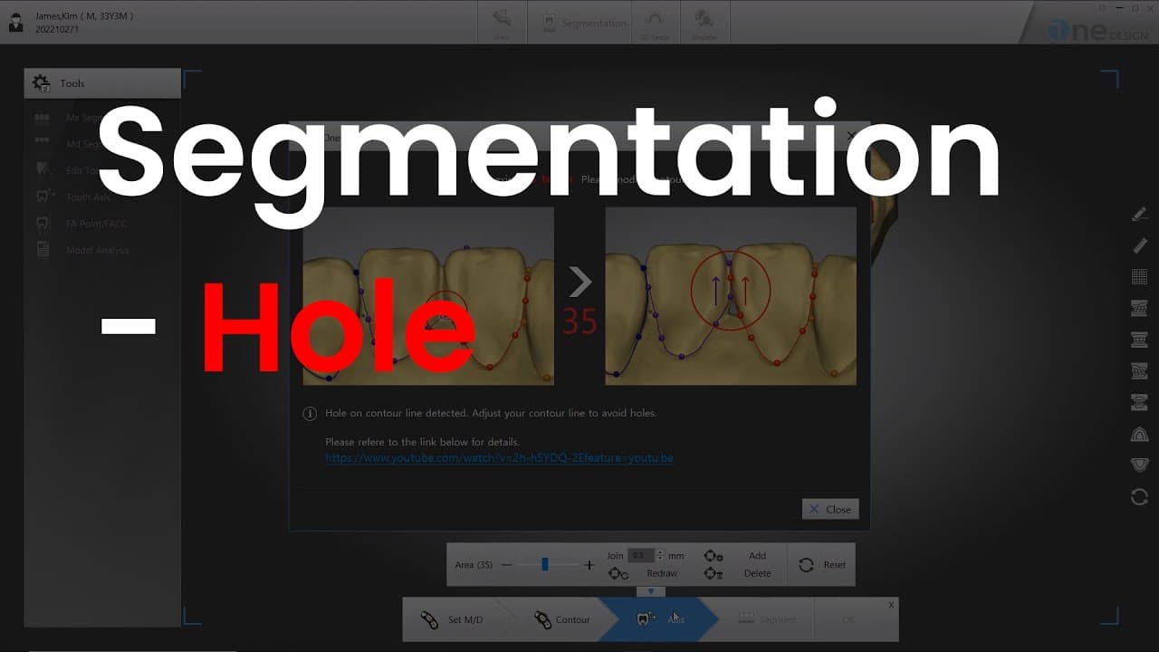 Hole 메시지 대처