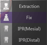 Fix 메뉴