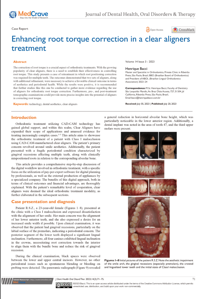 Enhancing root torque correction in a clear aligners treatment