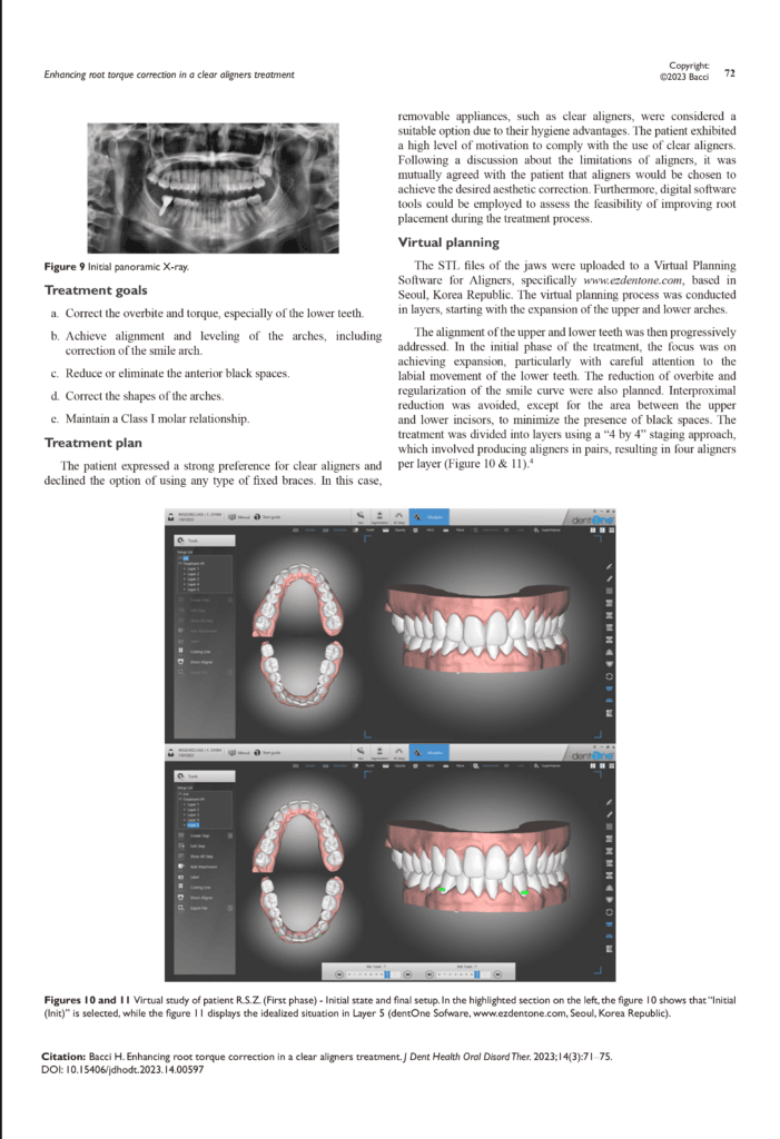 Enhancing root torque correction in a clear aligners treatment