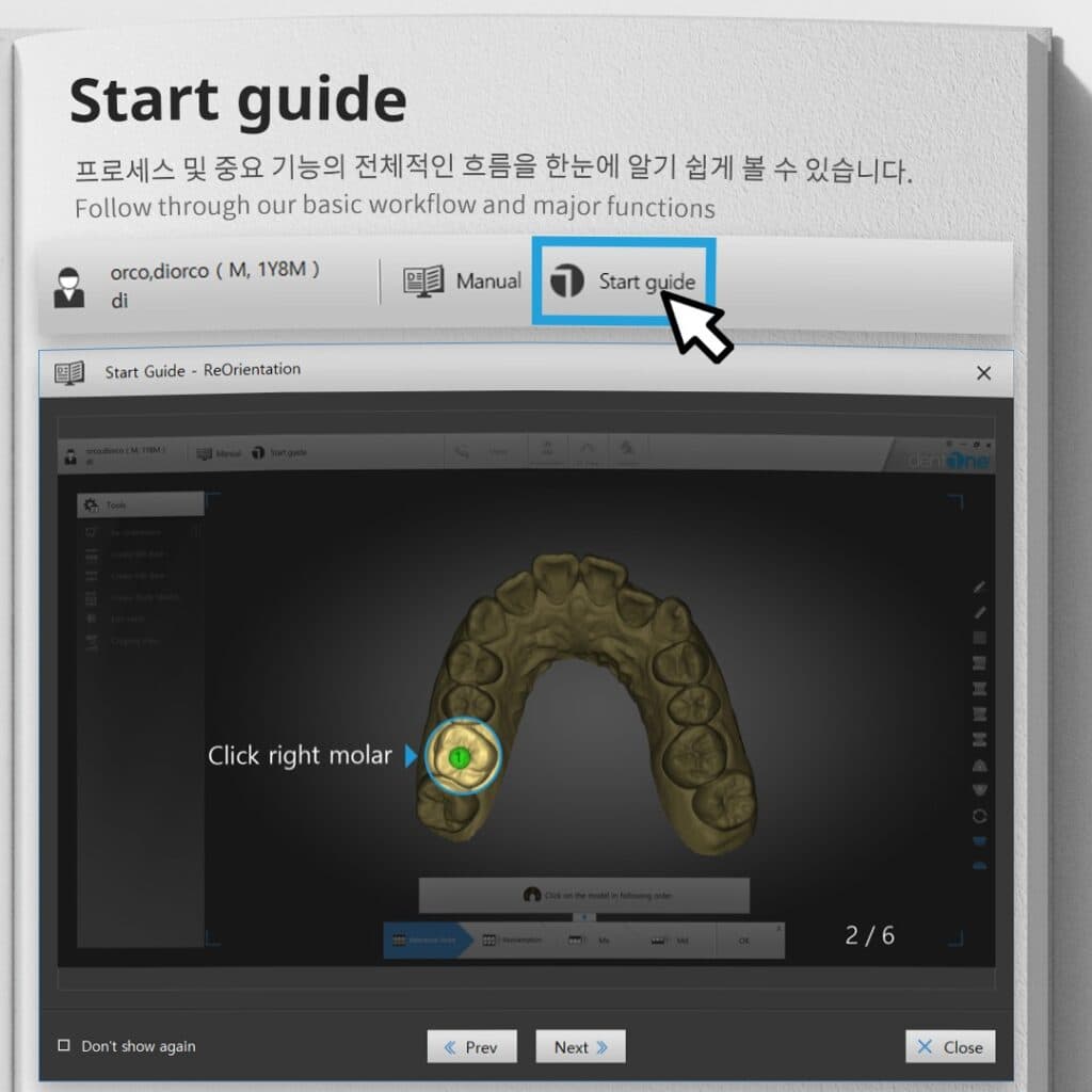 Now, dentOne operation is easier than ever!!!
