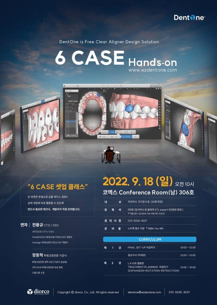 투명교정장치 6case 핸즈온