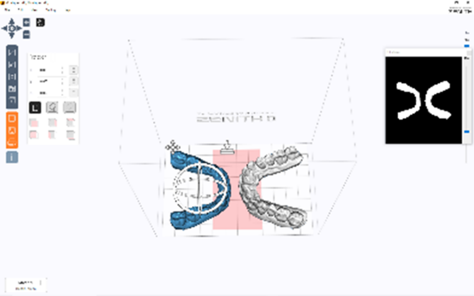 knowhow-print - dentOne / clearaligner / 3D Orthodontic Software