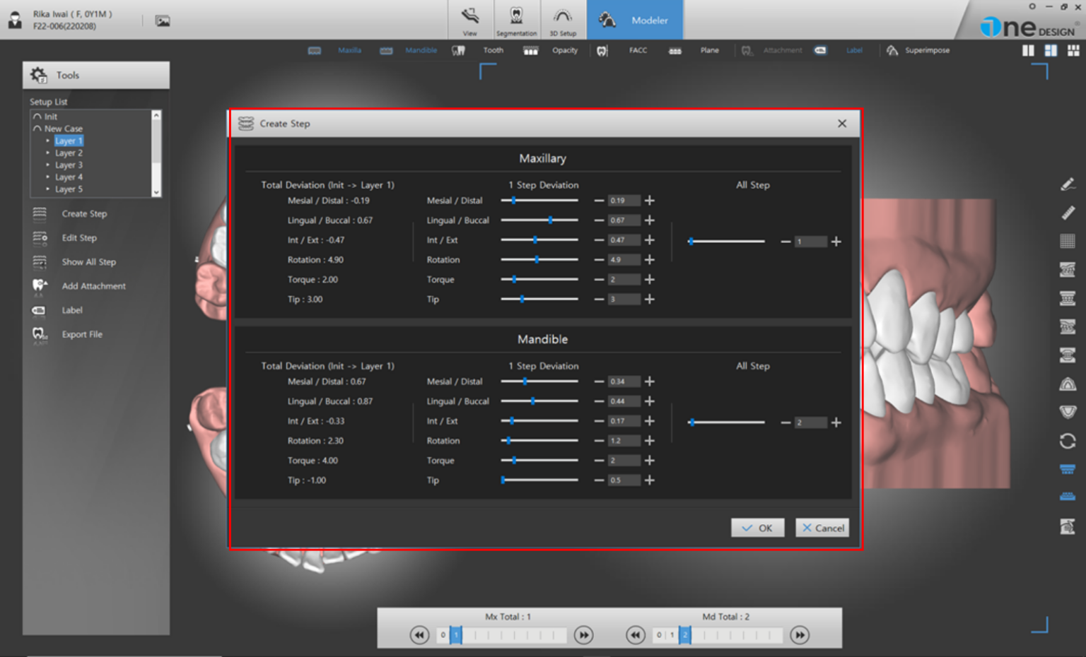 knowhow-design-dentone-clearaligner-3d-orthodontic-software