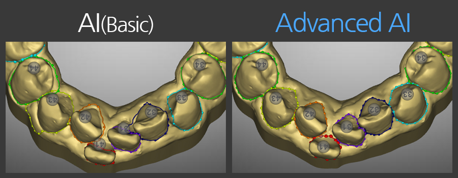 Segmentation-AI Advanced(2)
